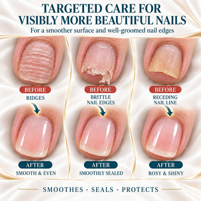💜💅Lilac Glossy Mirror Nail Strengthener | Lightweight Serum Locks Nail Moisture, Reinforce Nail Plate & Lower Damage Chance---Polarvix®