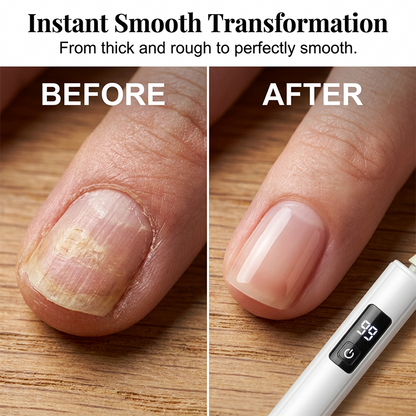 🥳2026 HOT SALE🥳50% OFF! 💅 Professional Electric Nail Polisher – Smooths thick nails. Multiple heads for shaping & buffing---Polarvix®